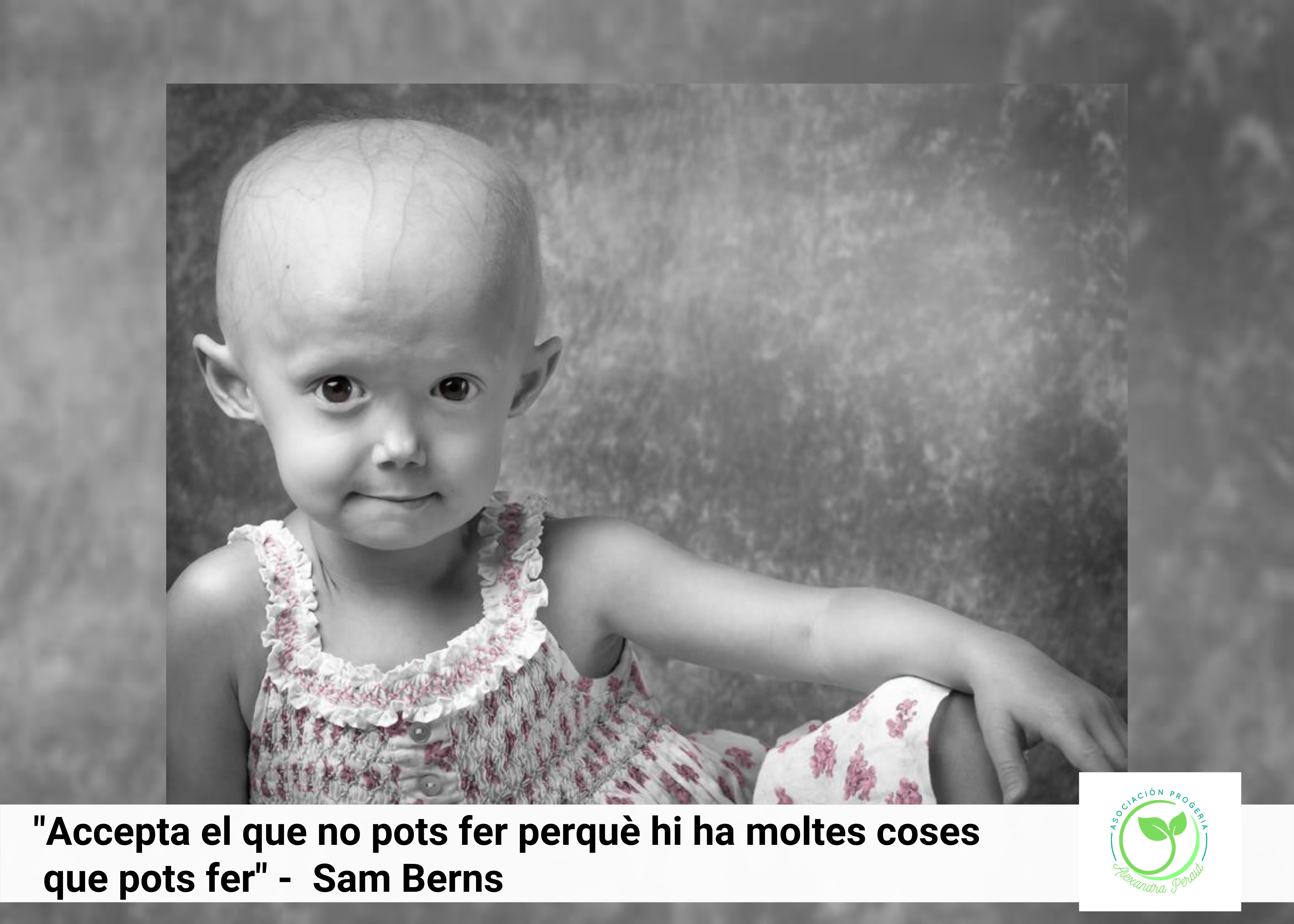 URL Asociación Progeria ALEXANDRA PERAUT