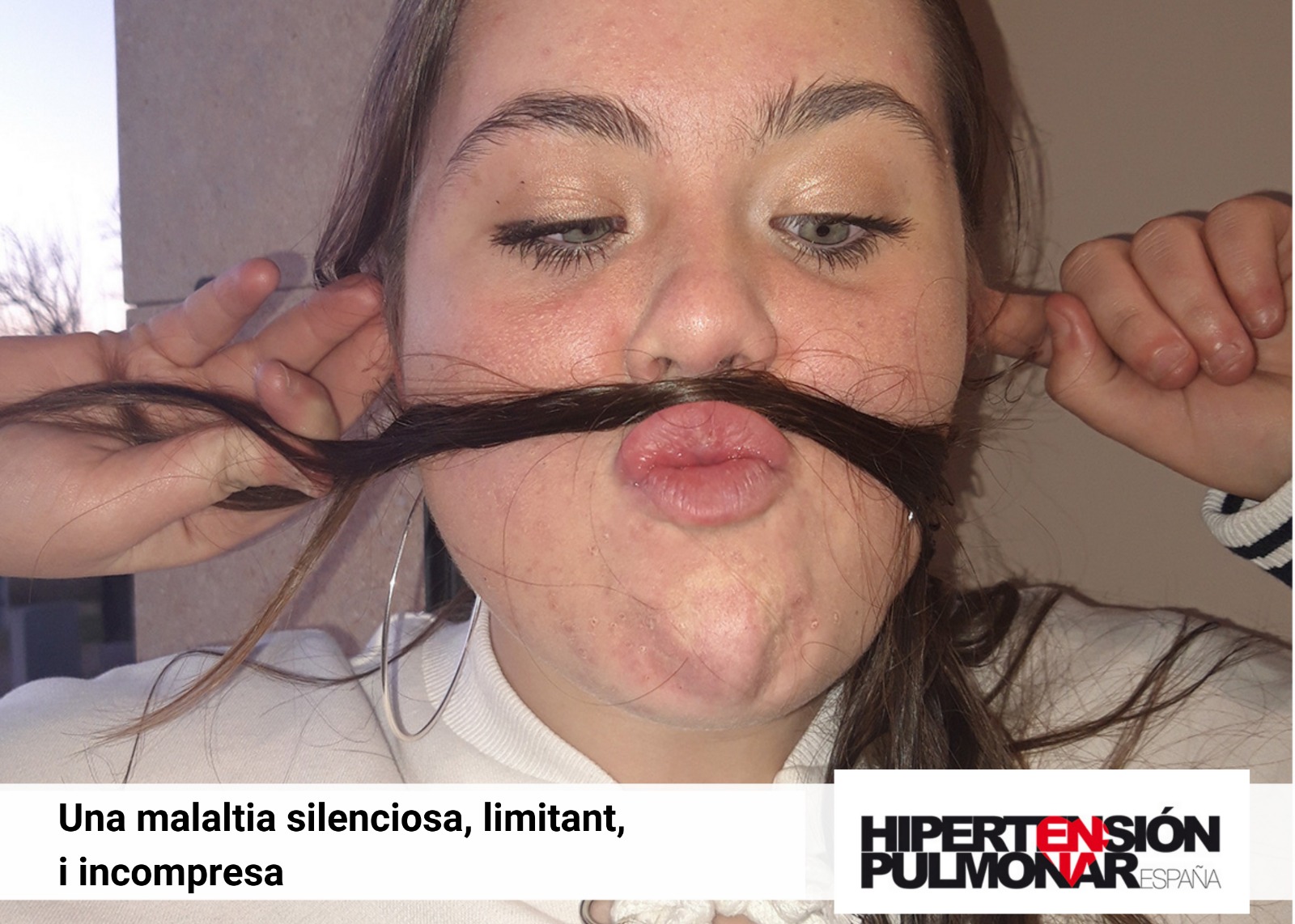  Peu de foto, logo de l’Associació d’Hipertensió Pulmonar d’Espanya. Fotografia de la cara d’una noia fent el gest amb els seus cabells posats sota el nas, com si fos el tub respiratori.