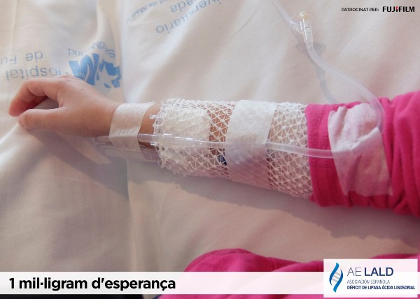 Peu de foto logo de l'Associació Espanyola de Dèficit de Lipasa Àcida Lisosomal, fotografia del braç dret d’una nena amb una via sobre el llit d’un hospital.