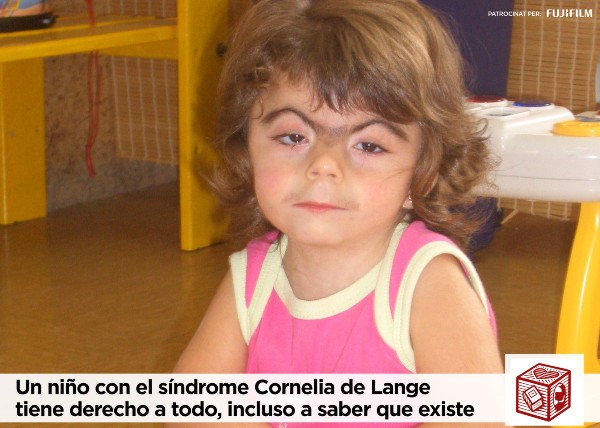 Peu de foto logo de l'Associació Espanyola de la Síndrome Cornelia de Lange, una nena afectada de Cornelia de Lange.
